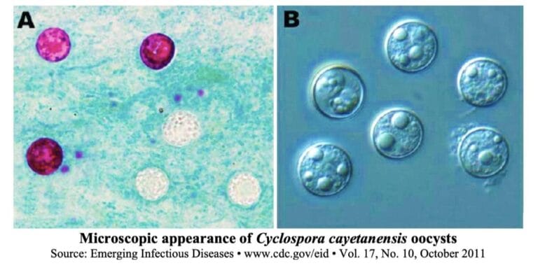 Cyclosporiasis Outbreak In USA